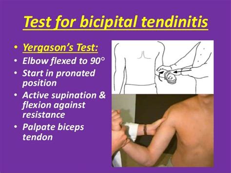 bicep tendo tear test|positive yergason's test shoulder.